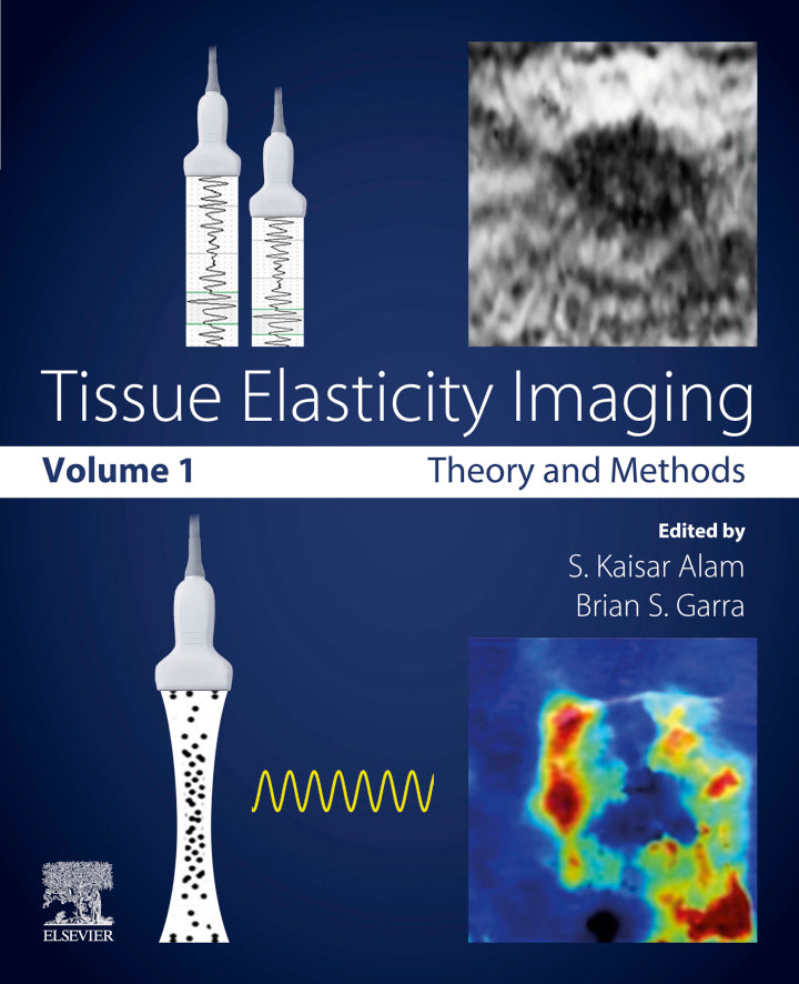 Tissue Elasticity Imaging Volume 1: Theory and Methods PDF E-book :